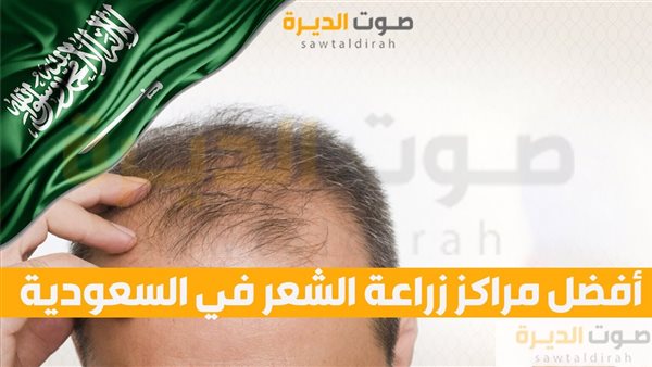 أفضل مراكز زراعة الشعر في السعودية